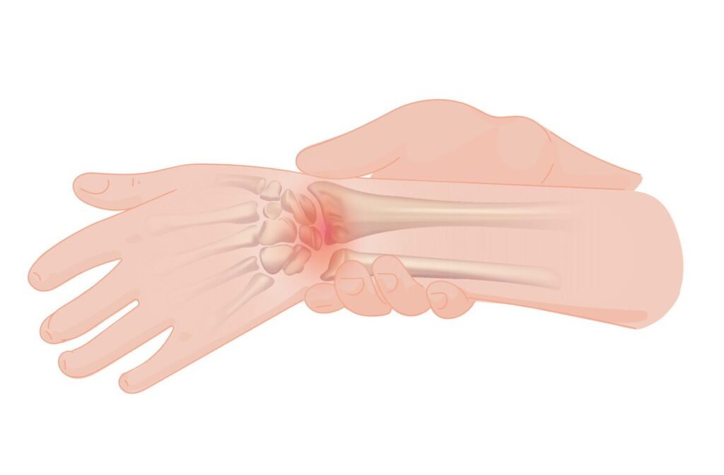 El bileği ve el bölgesini gösteren anatomik çizim
