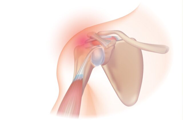 Omuz bölgesini gösteren anatomik çizim